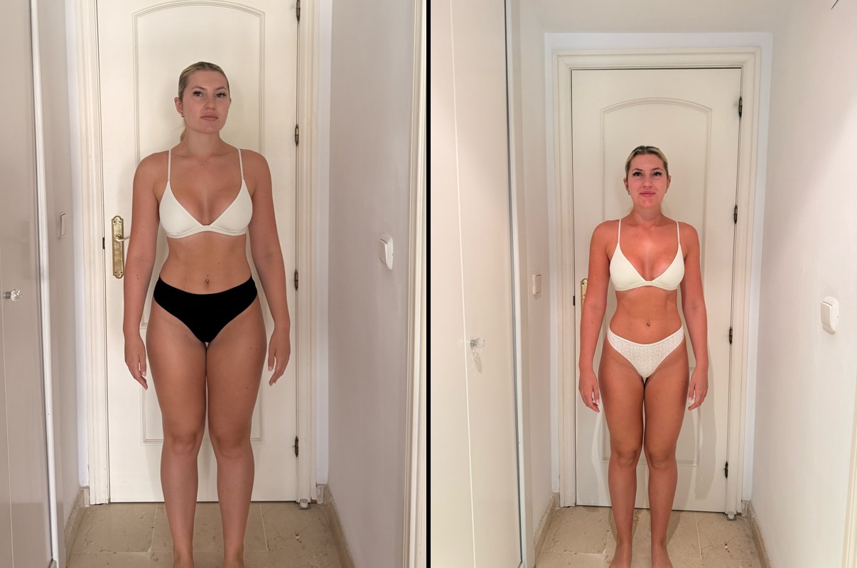 Amy before and after