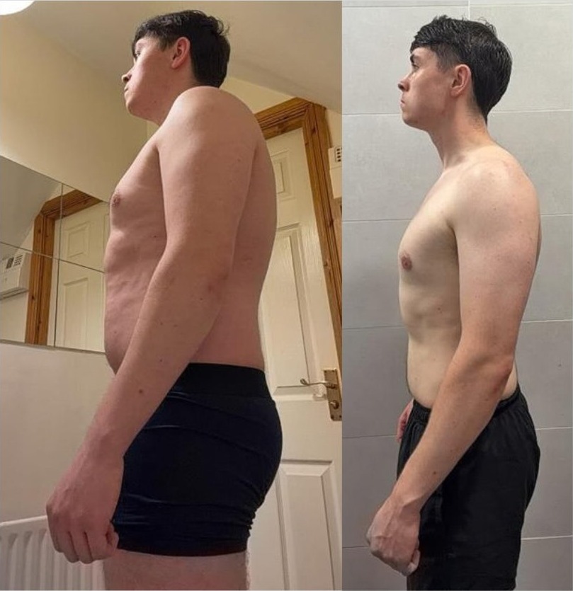 Conn before and after