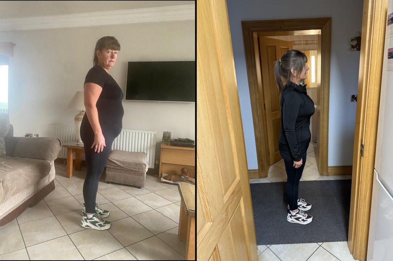 Bernadette before and after