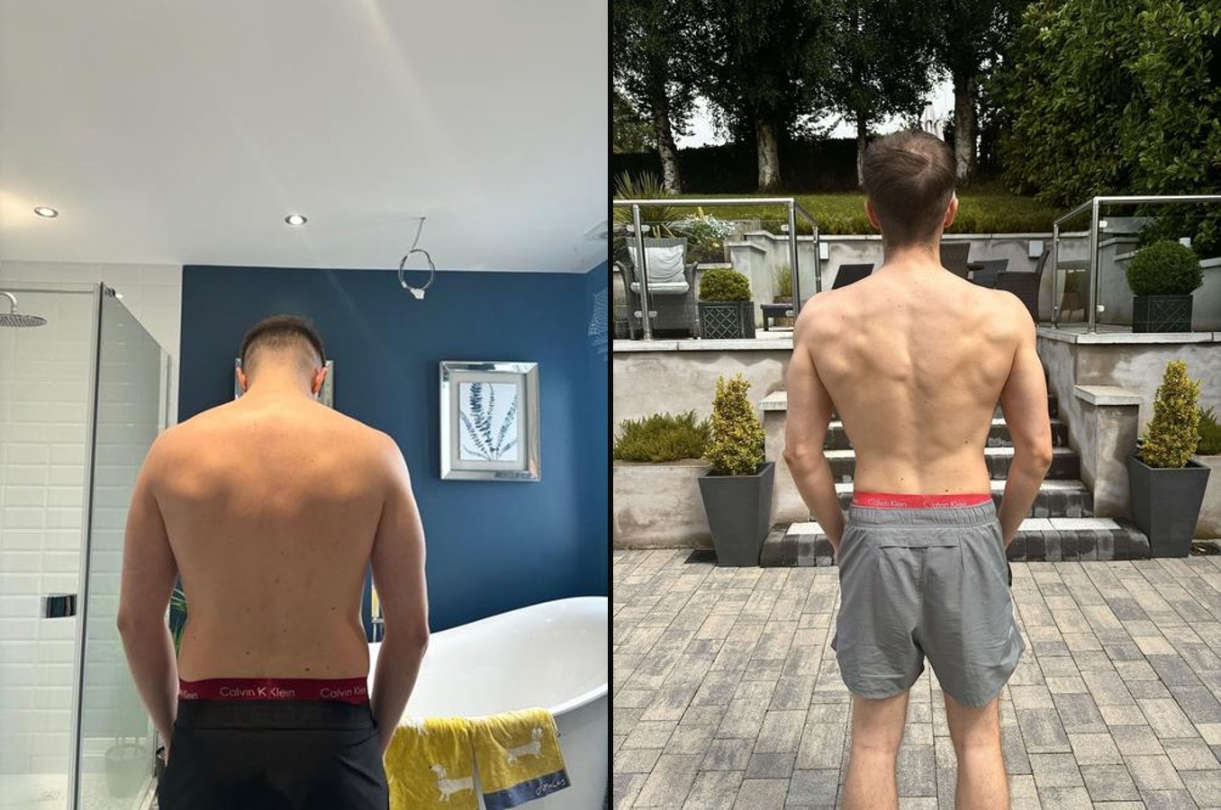 James before and after