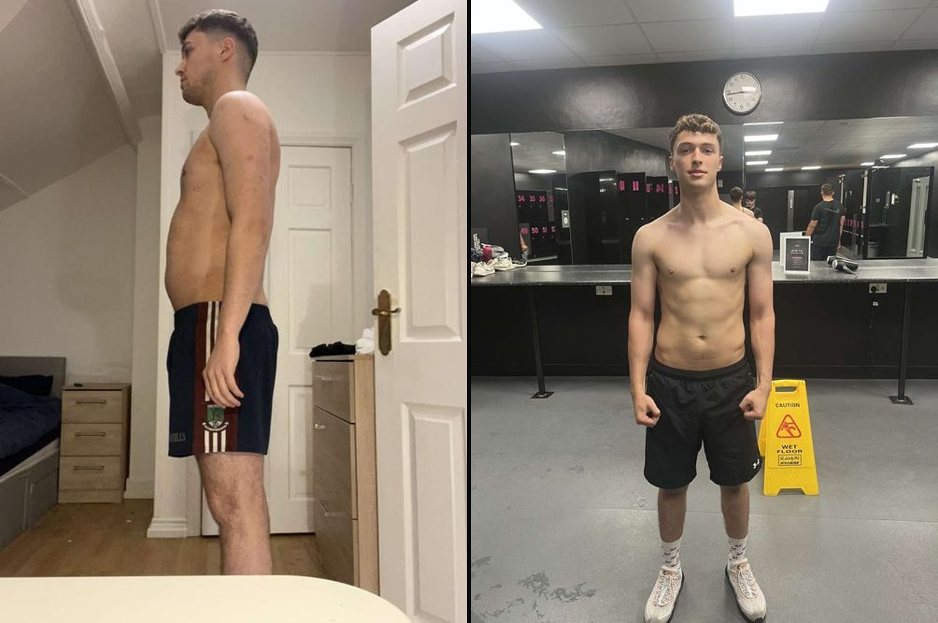 Oisin before and after