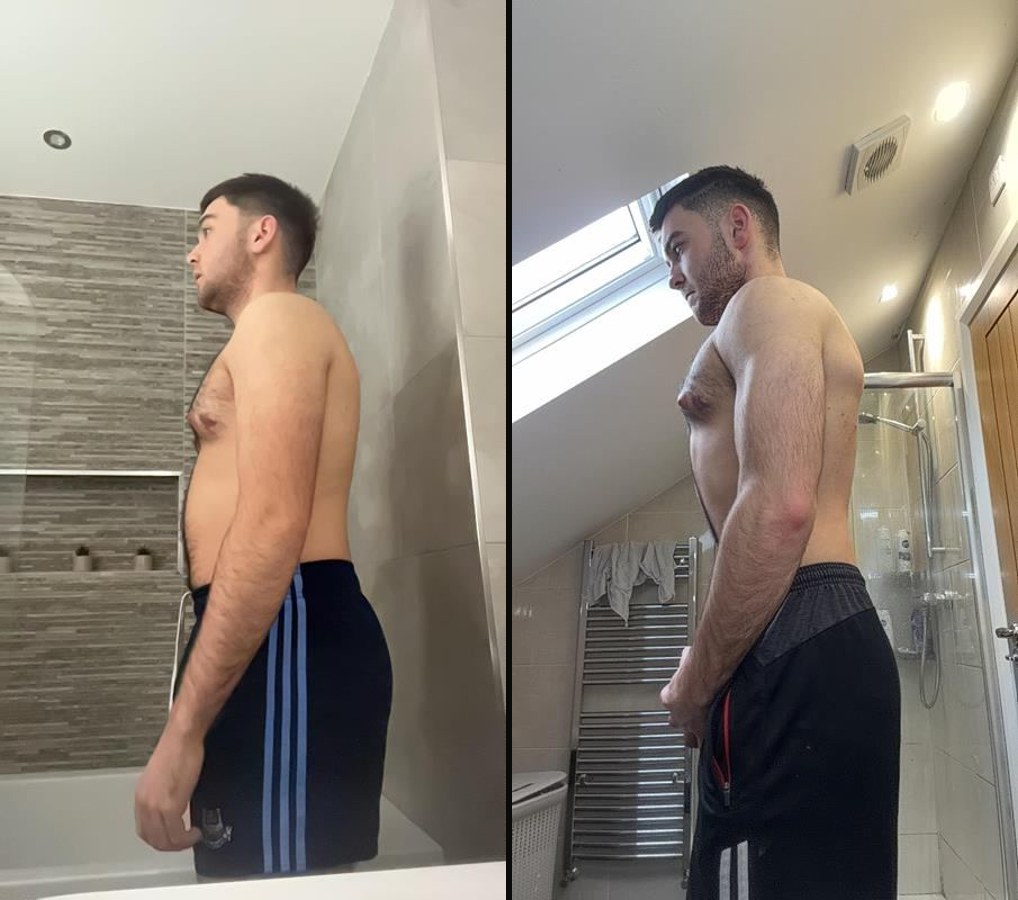 Ryan before and after