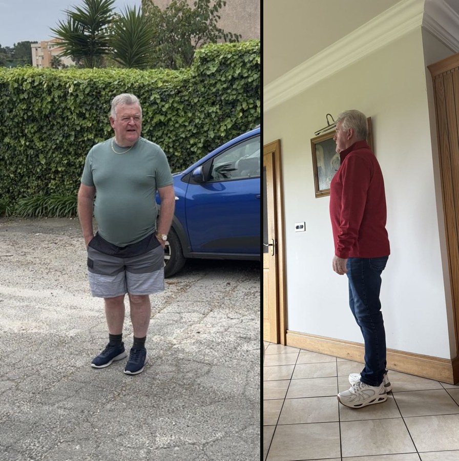 Eamon before and after