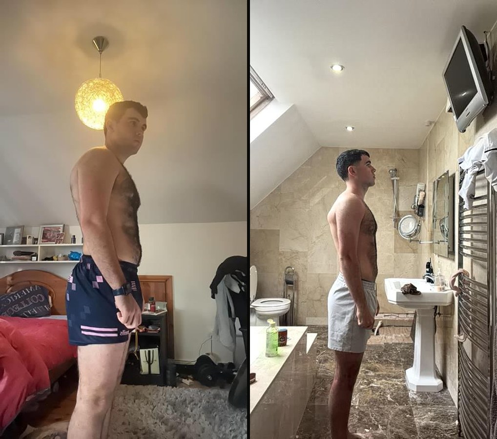 Seamus before and after
